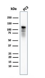 Drebrin 1 (DBN1) Antibody in Western Blot (WB)