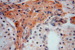 DHRS1 Antibody in Immunohistochemistry (Paraffin) (IHC (P))