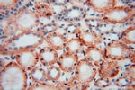 DHRS1 Antibody in Immunohistochemistry (Paraffin) (IHC (P))