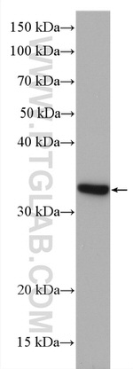 DHRS1 Antibody in Western Blot (WB)