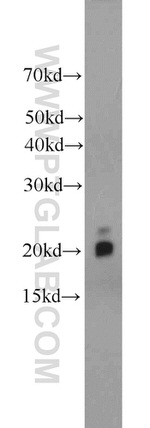 MYL12A Antibody in Western Blot (WB)
