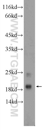 MYL12A Antibody in Western Blot (WB)