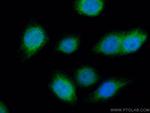 UAP1 Antibody in Immunocytochemistry (ICC/IF)