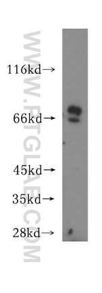 OCTN2 Antibody in Western Blot (WB)