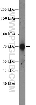 OCTN2 Antibody in Western Blot (WB)