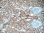 OCTN2 Antibody in Immunohistochemistry (Paraffin) (IHC (P))