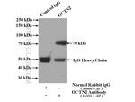 OCTN2 Antibody in Immunoprecipitation (IP)