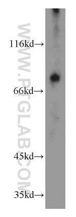 OCTN2 Antibody in Western Blot (WB)