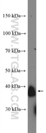 CD157 Antibody in Western Blot (WB)