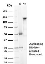Decorin Antibody in SDS-PAGE (SDS-PAGE)