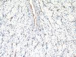 AGER Antibody in Immunohistochemistry (Paraffin) (IHC (P))