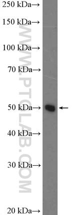 PAH Antibody in Western Blot (WB)