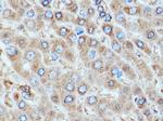 Alpha-1-Antitrypsin Antibody in Immunohistochemistry (Paraffin) (IHC (P))