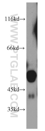 Alpha-1-Antitrypsin Antibody in Western Blot (WB)