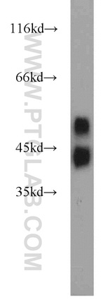 Alpha-1-Antitrypsin Antibody in Western Blot (WB)