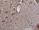 Alpha-1-Antitrypsin Antibody in Immunohistochemistry (Paraffin) (IHC (P))