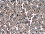 Alpha-1-Antitrypsin Antibody in Immunohistochemistry (Paraffin) (IHC (P))