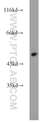 Alpha-1-Antitrypsin Antibody in Western Blot (WB)