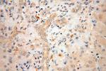 RPL23A Antibody in Immunohistochemistry (Paraffin) (IHC (P))