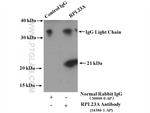 RPL23A Antibody in Immunoprecipitation (IP)