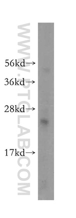 RPL23A Antibody in Western Blot (WB)