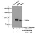 RIN1 Antibody in Immunoprecipitation (IP)