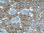 NRF2/NFE2L2 Antibody in Immunohistochemistry (Paraffin) (IHC (P))