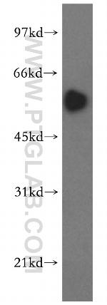 SMAD9 Antibody in Western Blot (WB)