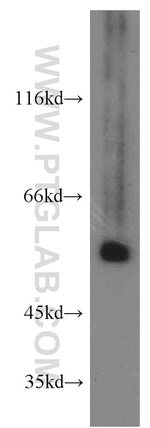 SMAD9 Antibody in Western Blot (WB)