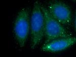 Antithrombin III Antibody in Immunocytochemistry (ICC/IF)