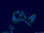 ENO3 Antibody in Immunocytochemistry (ICC/IF)