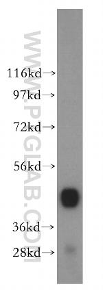 ENO3 Antibody in Western Blot (WB)