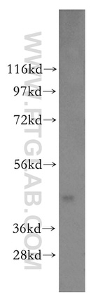 ENO3 Antibody in Western Blot (WB)