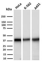 Aldo-keto Reductase Family 1 Member C2/DD2 Antibody in Western Blot (WB)