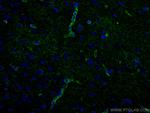 Aquaporin 4 Antibody in Immunohistochemistry (PFA fixed) (IHC (PFA))