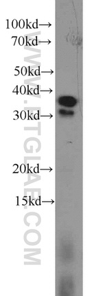 Aquaporin 4 Antibody in Western Blot (WB)