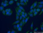 EDC3 Antibody in Immunocytochemistry (ICC/IF)