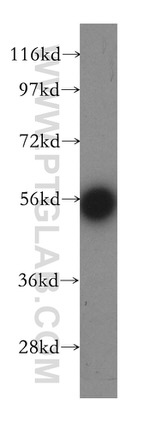 EDC3 Antibody in Western Blot (WB)