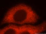 RPS12 Antibody in Immunocytochemistry (ICC/IF)