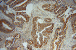 RPS12 Antibody in Immunohistochemistry (Paraffin) (IHC (P))