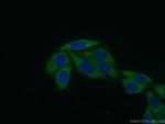 RPL31 Antibody in Immunocytochemistry (ICC/IF)