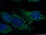 MCEE Antibody in Immunocytochemistry (ICC/IF)