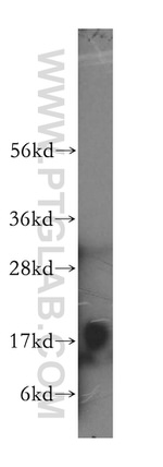 MCEE Antibody in Western Blot (WB)