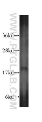 MCEE Antibody in Western Blot (WB)