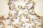 FBXL8 Antibody in Immunohistochemistry (Paraffin) (IHC (P))