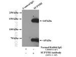 SUPT5H Antibody in Immunoprecipitation (IP)