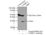 CTHRC1 Antibody in Immunoprecipitation (IP)