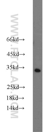 CTHRC1 Antibody in Western Blot (WB)