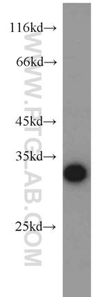 CTHRC1 Antibody in Western Blot (WB)