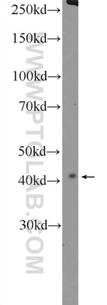 HEXIM2 Antibody in Western Blot (WB)